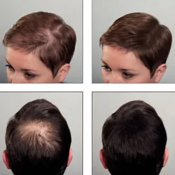 Sibel - Hair Sculptor Hair Building Fibers Dark Blonde 25 g