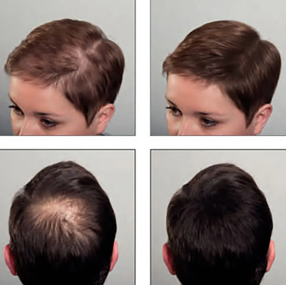 Supreme Trimmer Black HairThik Hair Fibers Kit 25g